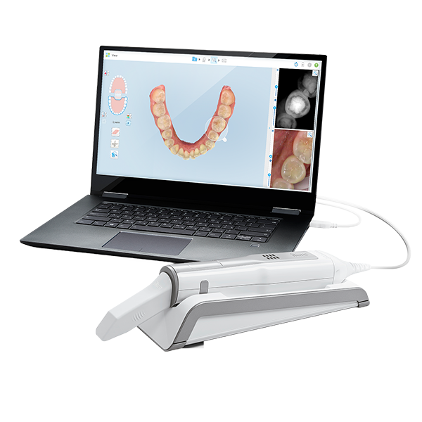 iTero Lumina™ Intraoral-Scanner | inkl. Serviceplan 1 Jahr | 523063