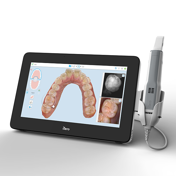 iTero Lumina™ Intraoral-Scanner