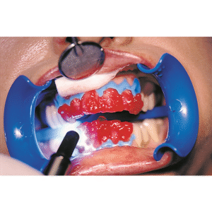 Bleach'n Smile Automix Set – Bild 3