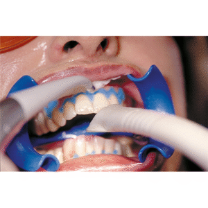 After Bleaching Care Refill Set – Bild 4