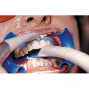 Bleach'n Smile Automix Set, - Image 4