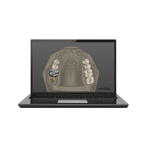 Tizian Creativ RT TruSmile module, - Image 1