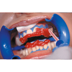 Bleach'n Smile Automix Set – Bild 2