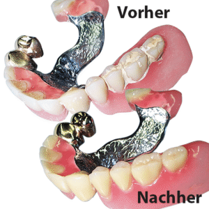 Microclean – Bild 3